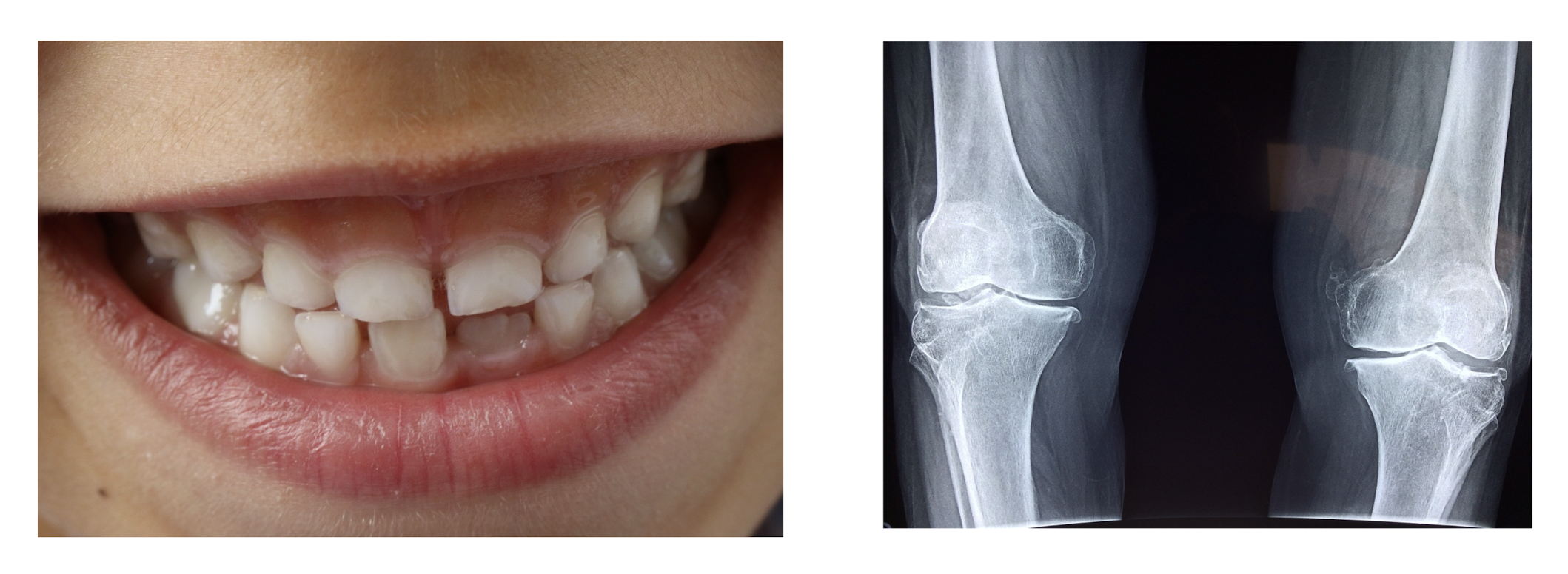 스크린샷 2024-11-18 오후 1
